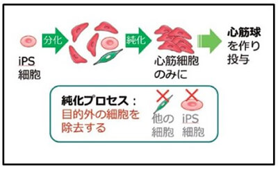 iPS細胞を用いた心筋再生医療の全体像